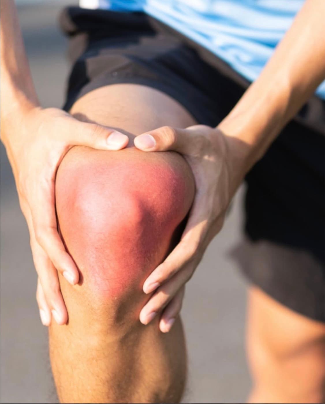 Evaluación clínica de lesión de rodilla